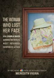 The Woman Who Lost Her Face: How Charla Nash Survived the World's Most Infamous Chimpanzee Attack