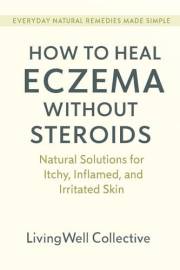 How to Heal Eczema Naturally Without Steroids: Natural Solutions for Itchy, Inflamed, and Irritated Skin (Everyday Natural Re